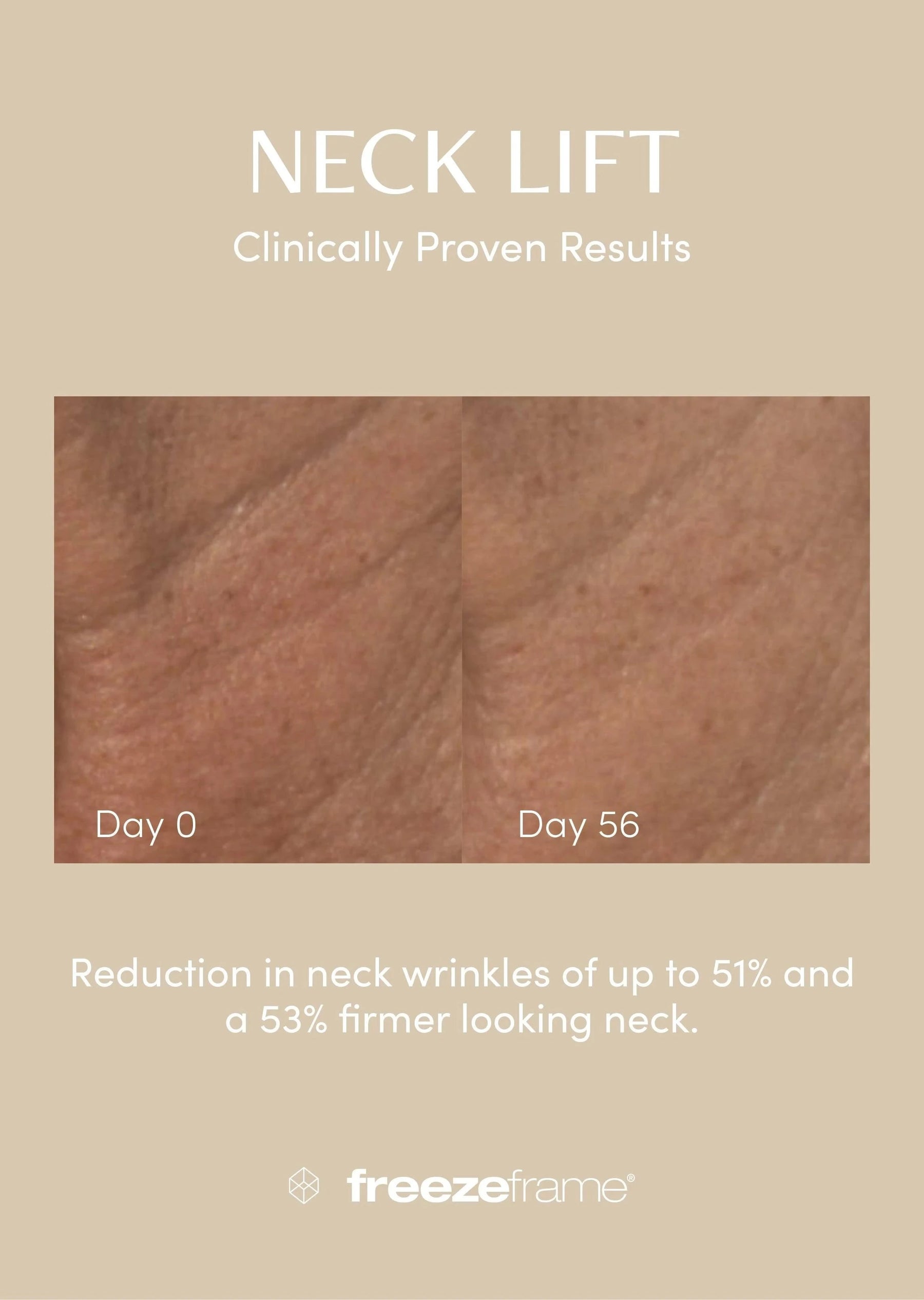 freezeframe freezeframe Neck Lift 50ml Neck & Decolletage