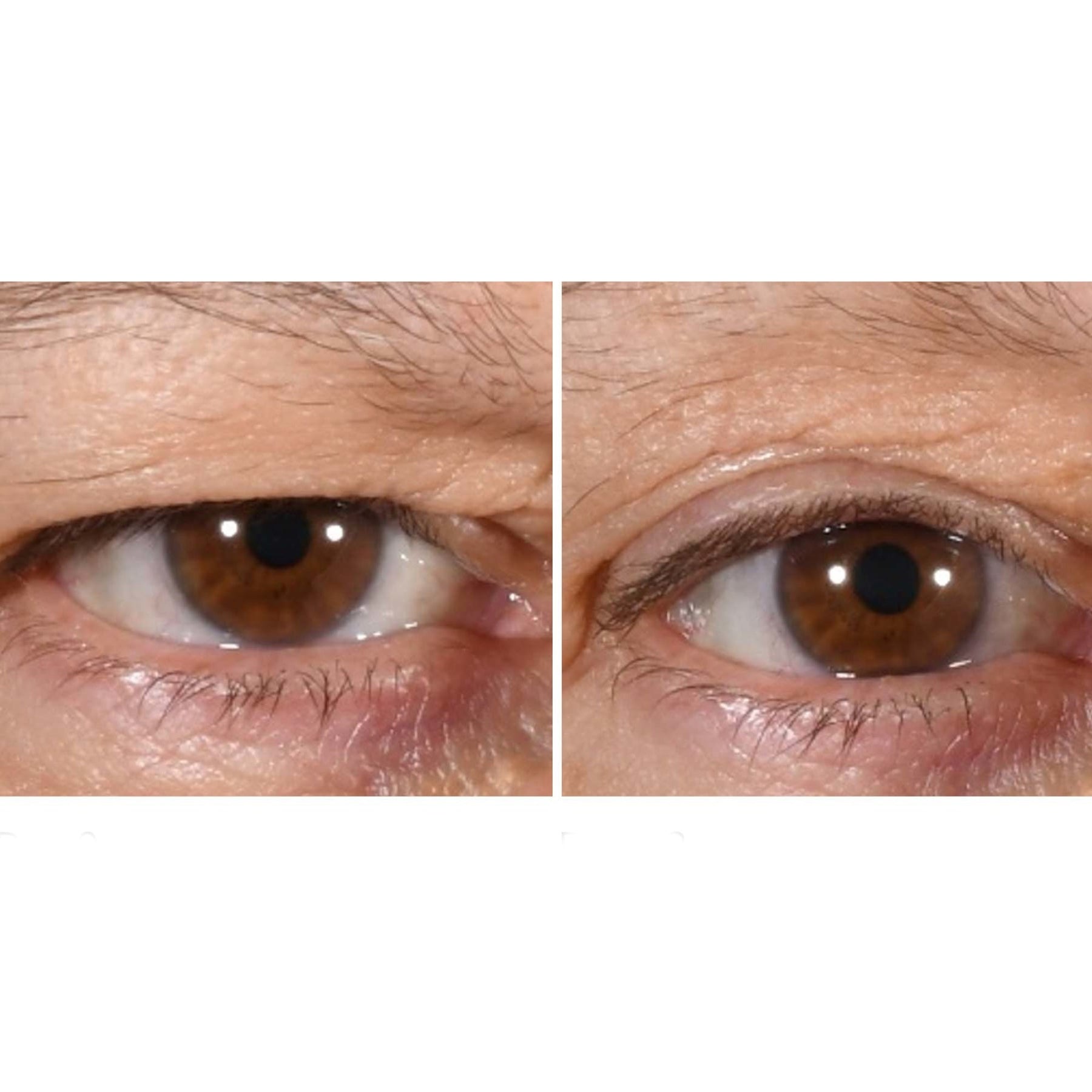 freezeframe freezeframe Eyelid Lift 15ml Skin Care