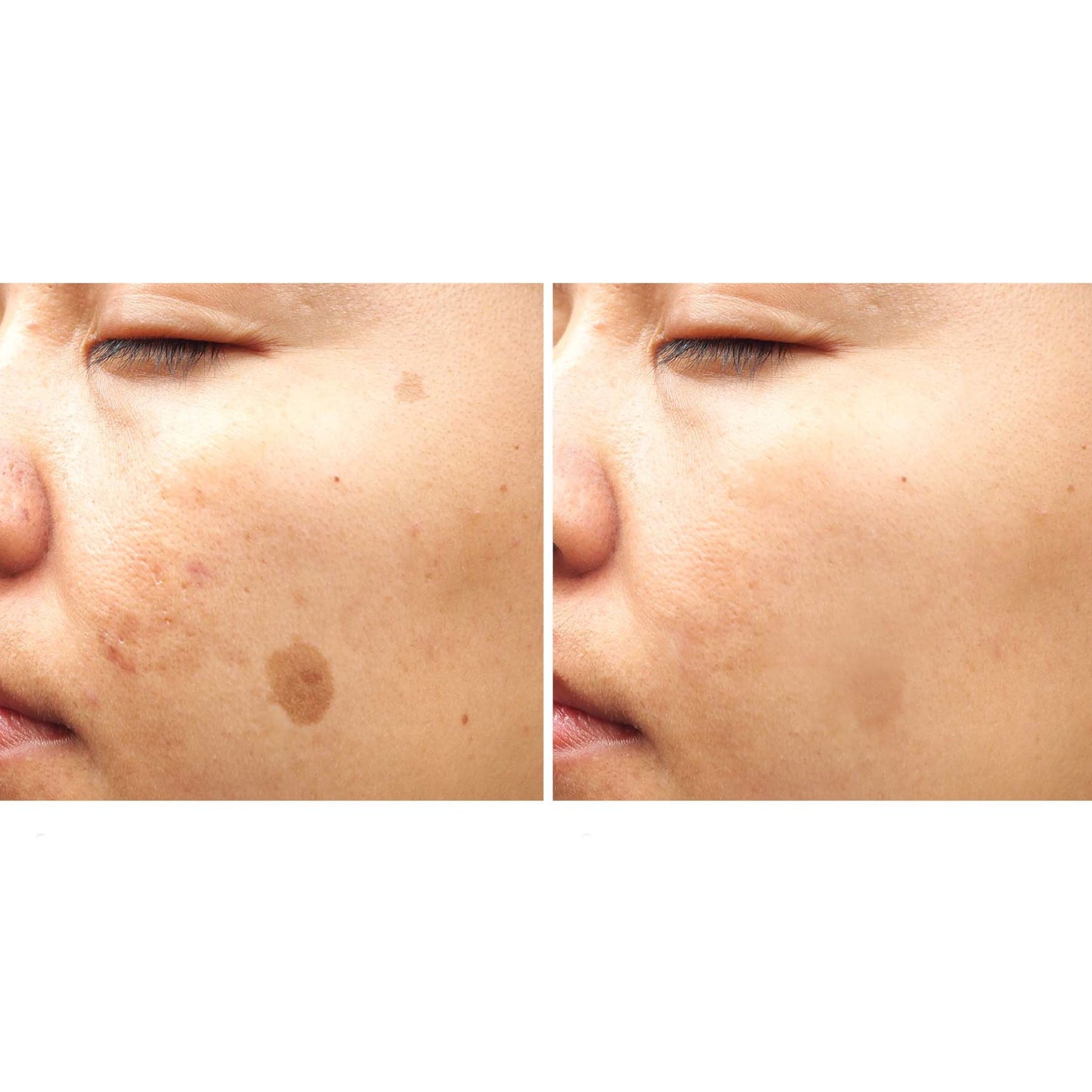 freezeframe freezeframe Pigment Clear 25ml Skin Care