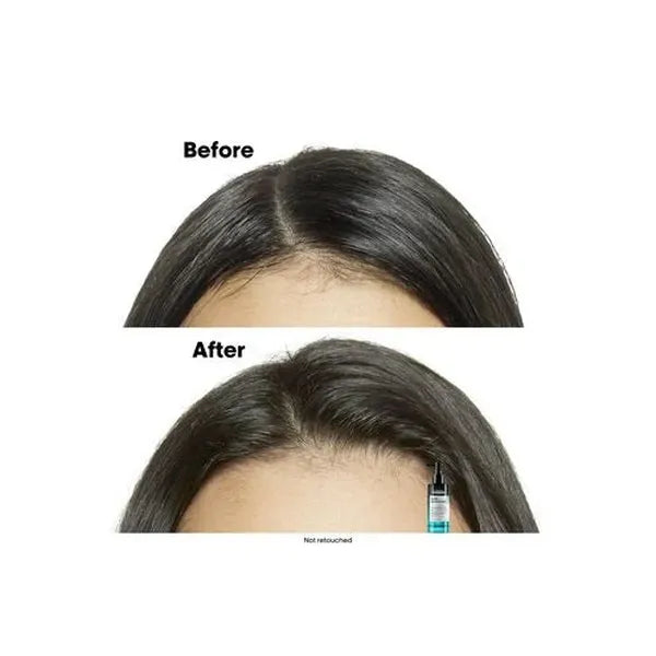 LOreal Professionnel Loreal Professionel Serie Expert Scalp Advanced Anti-Oilyness Serum 90ml Hair Oils & Serums