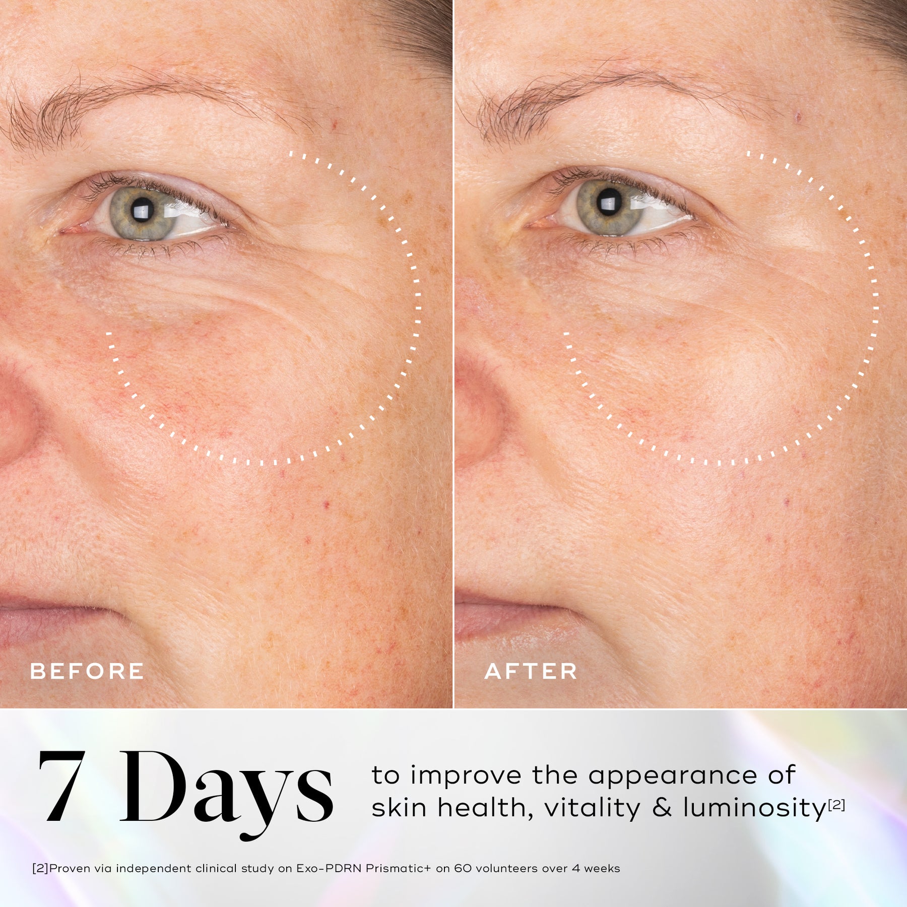 Medik8 Medik8 Exo-PDRN Prismatic+ 30ml Serums & Treatments