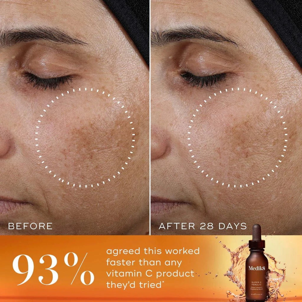 Medik8 Medik8 Super C Ferulic 30ml Serums & Treatments