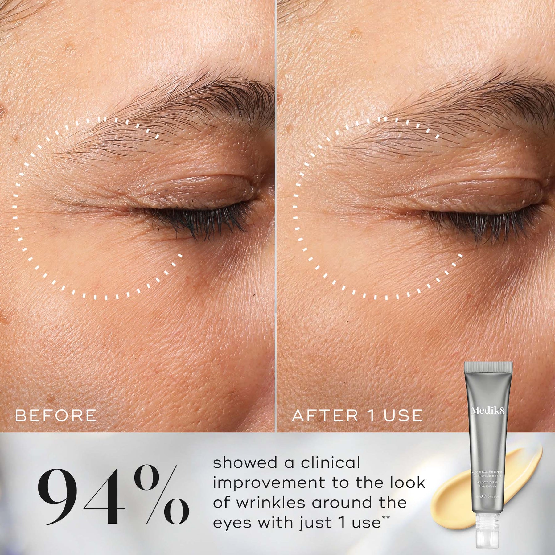 Medik8 Medik8 Crystal Retinal Ceramide Eye 6 15ml Skin Care