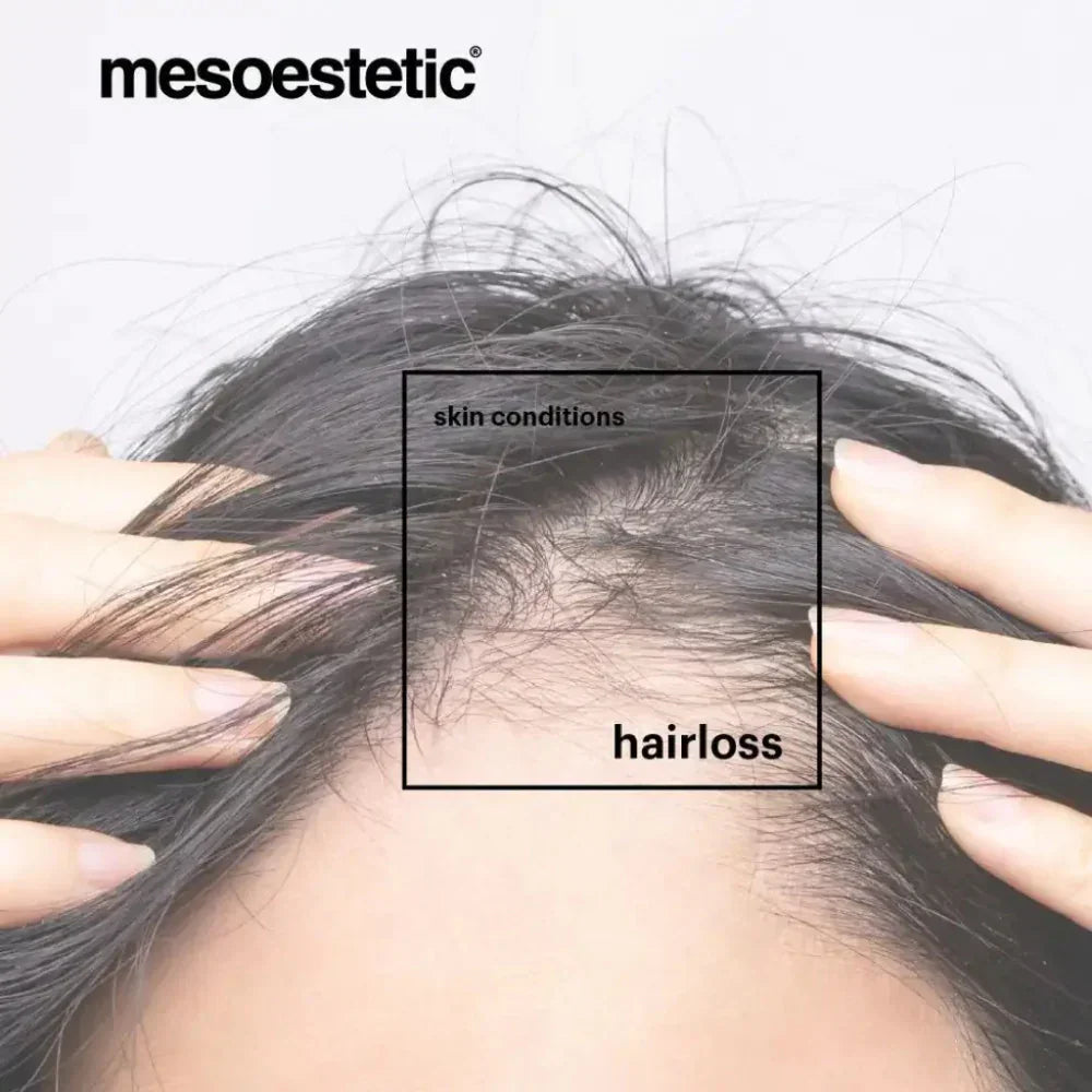 Mesoestetic Mesoestetic Tricology Shampoo 225ml Hair Care