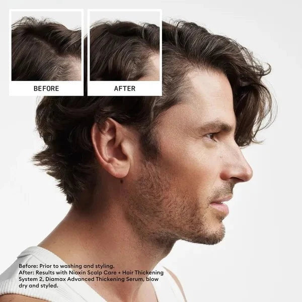 Nioxin Nioxin Scalp + Hair Thickening System 2 Trial Kit Hair Care [Health and Beauty]