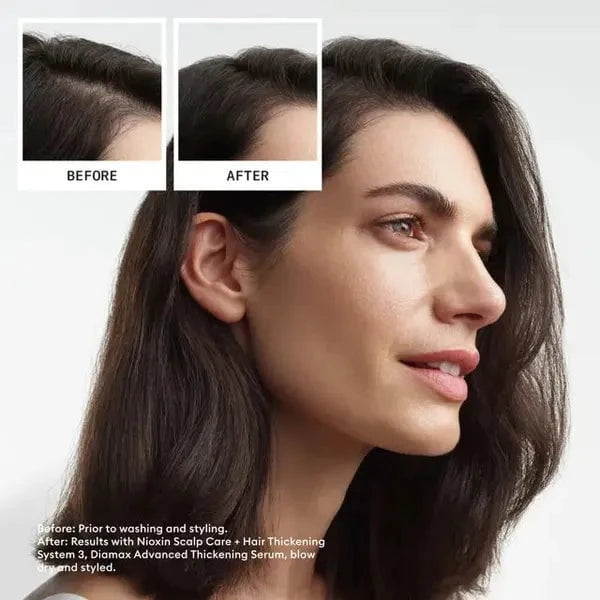 Nioxin Nioxin Scalp + Hair Thickening System 3 Full Size Kit Hair Care [Health and Beauty]