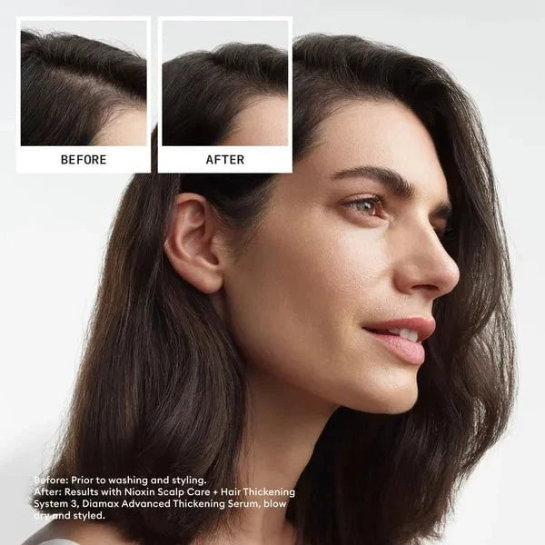 Nioxin Nioxin Scalp + Hair Thickening System 3 Trial Kit Hair Care [Health and Beauty]