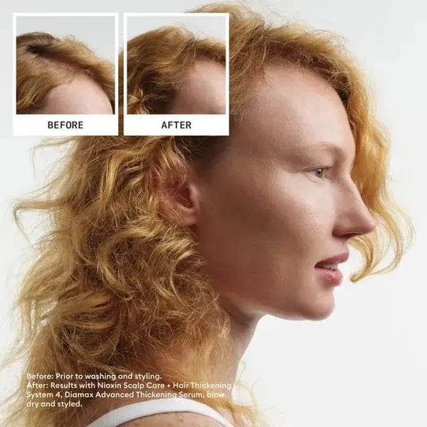 Nioxin Nioxin Scalp + Hair Thickening System 4 Full Size Kit Hair Care [Health and Beauty]