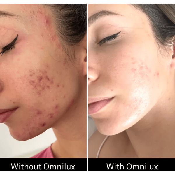 Omnilux Omnilux Clear LED Light Therapy