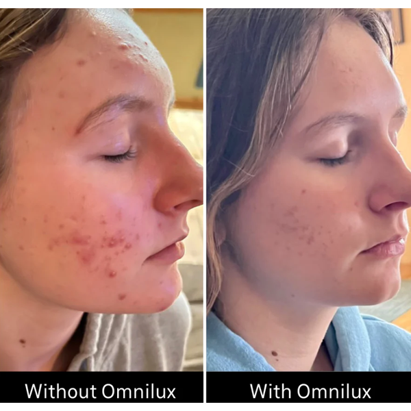 Omnilux Omnilux Clear LED Light Therapy