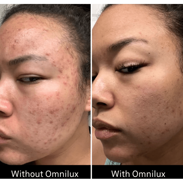 Omnilux Omnilux Clear LED Light Therapy