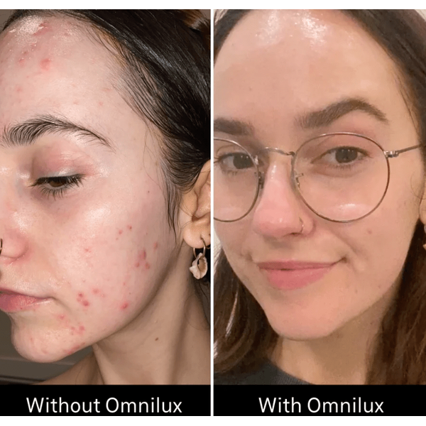 Omnilux Omnilux Clear LED Light Therapy