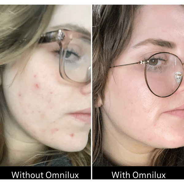 Omnilux Omnilux Clear LED Light Therapy
