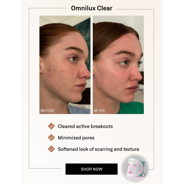 Omnilux Omnilux Clear LED Light Therapy