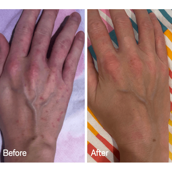 Omnilux Omnilux Contour Glove LED Light Therapy