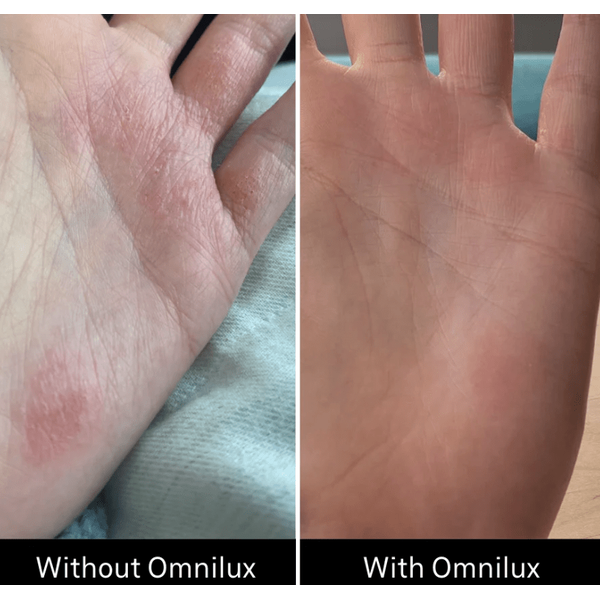 Omnilux Omnilux Contour Glove LED Light Therapy