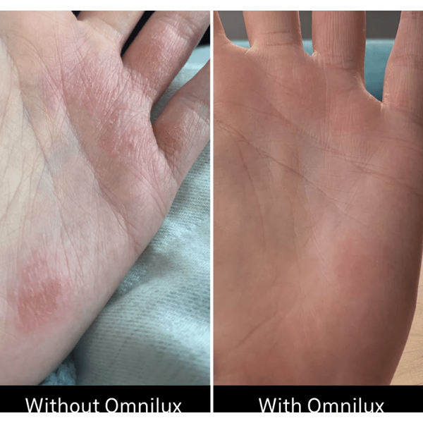 Omnilux Omnilux Contour Glove LED Light Therapy