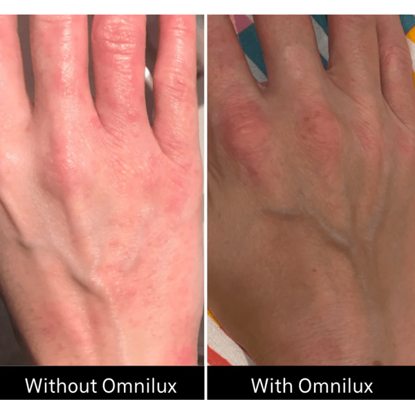 Omnilux Omnilux Contour Glove LED Light Therapy