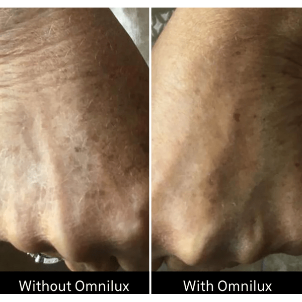 Omnilux Omnilux Contour Glove LED Light Therapy