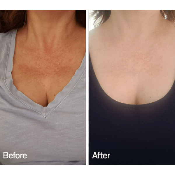 Omnilux Omnilux Contour Neck & Décolleté LED Light Therapy