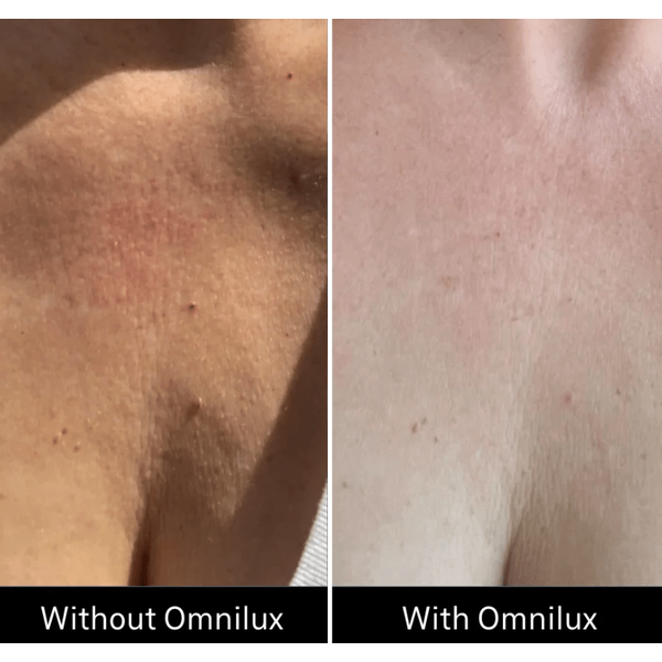 Omnilux Omnilux Contour Neck & Décolleté LED Light Therapy