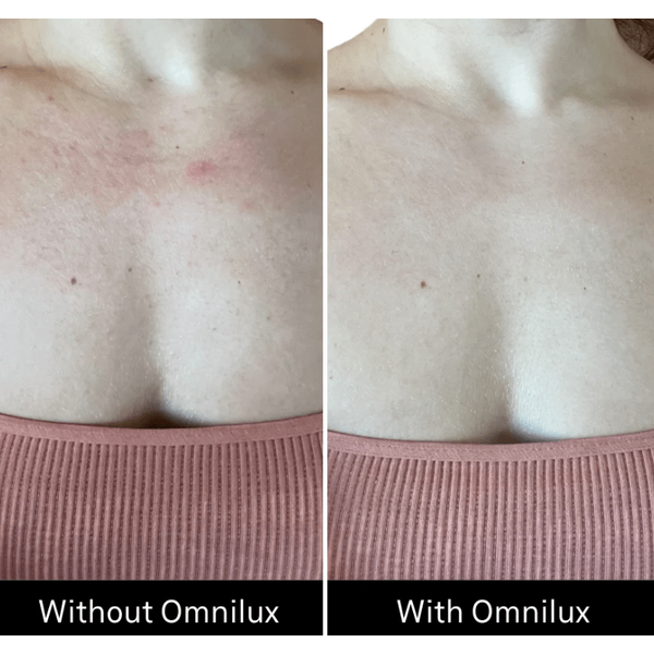 Omnilux Omnilux Contour Neck & Décolleté LED Light Therapy