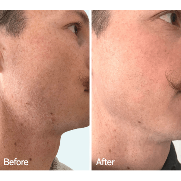 Omnilux Omnilux Men LED Light Therapy