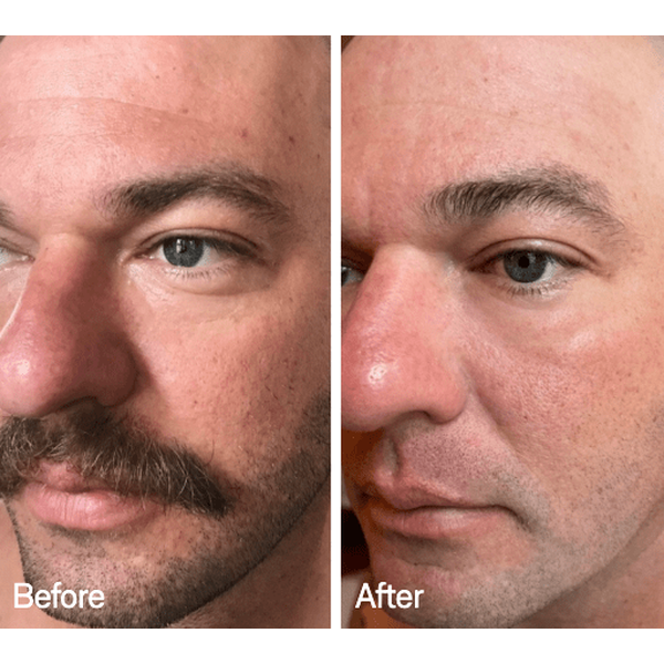 Omnilux Omnilux Men LED Light Therapy