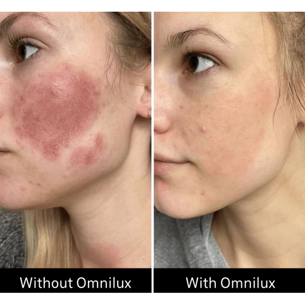 Omnilux Omnilux Contour Face