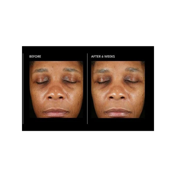 PCA Skin PCA Skin Hyaluronic Acid Overnight Mask 51g Anti-Ageing Serum