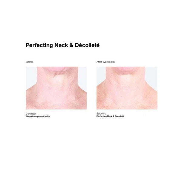 PCA Skin PCA Skin Perfecting Neck & Decollete 85g Moisturisers