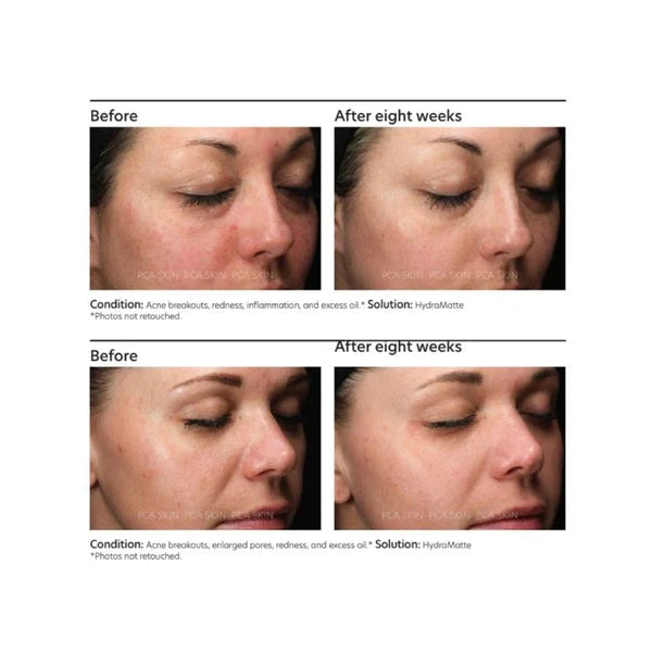 PCA Skin PCA Skin HydraMatte 51g