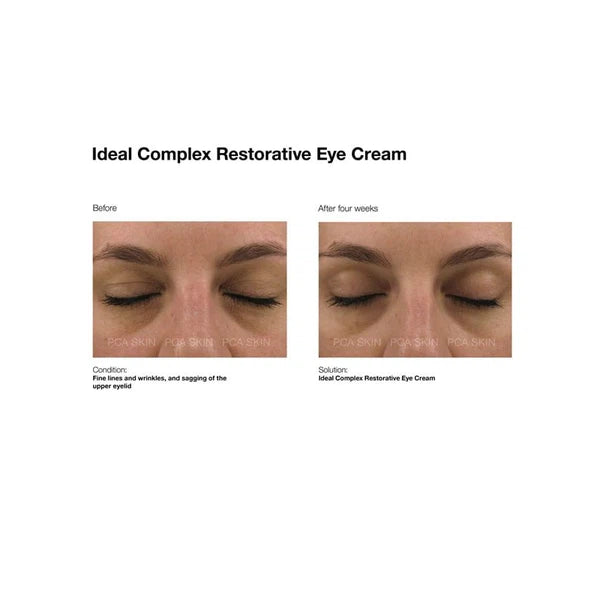 PCA Skin PCA Skin ideal complex Restorative Eye Cream 14.2g