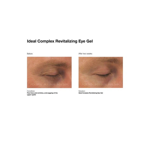 PCA Skin PCA Skin ideal complex Revitalizing Eye Gel 14.2g