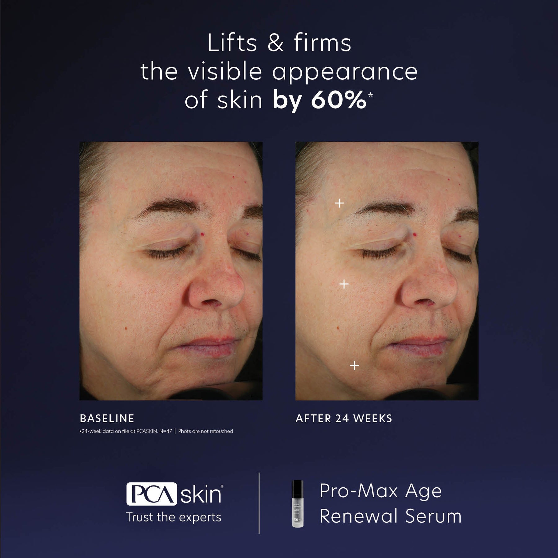 PCA Skin PCA Skin Pro-Max Age Renewal 29ml Serums & Treatments