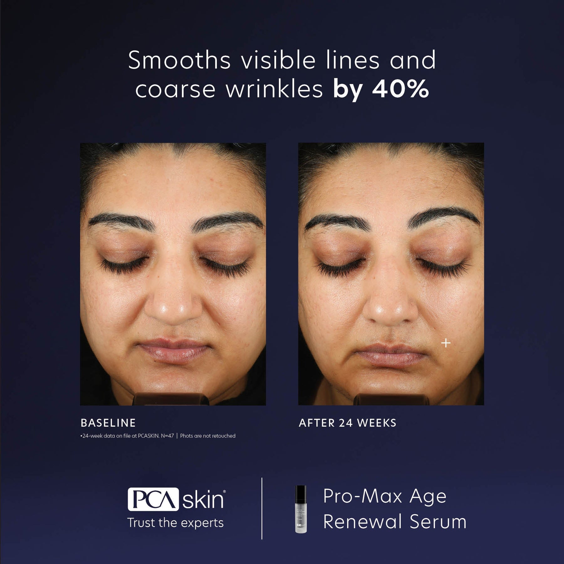 PCA Skin PCA Skin Pro-Max Age Renewal 29ml Serums & Treatments