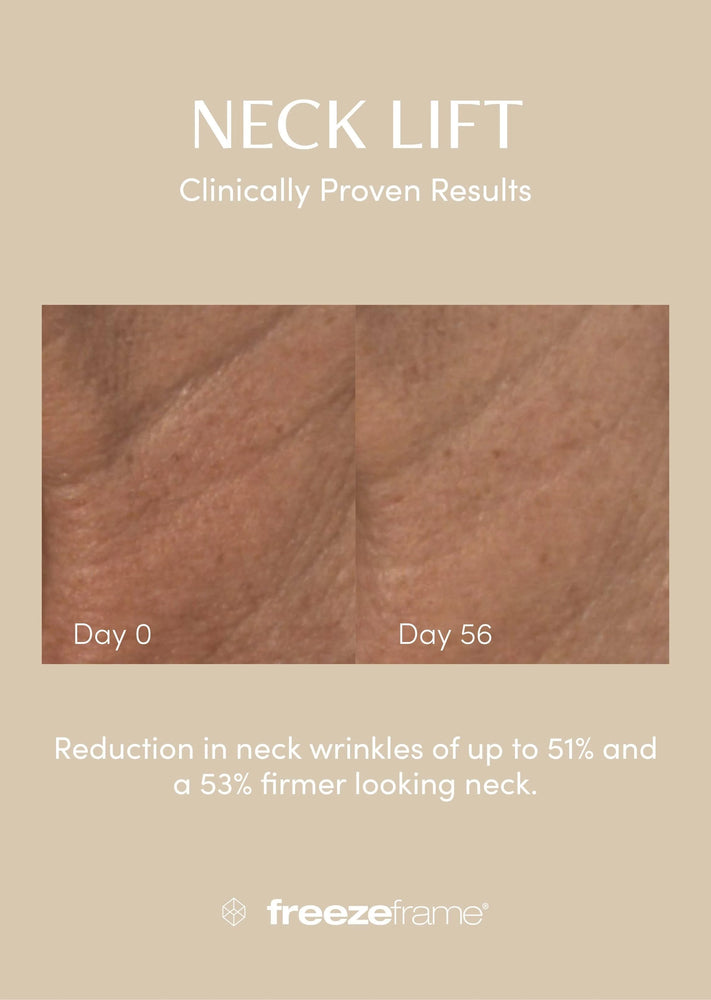 freezeframe Neck Lift 50ml