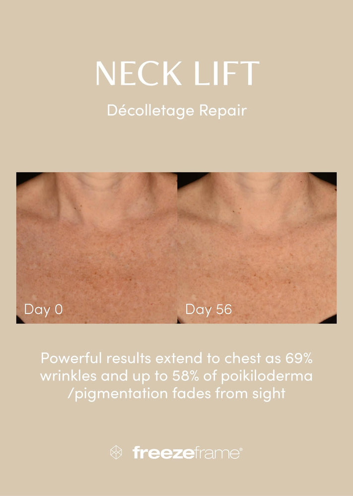 freezeframe Neck Lift 50ml