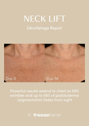 freezeframe Neck Lift 50ml