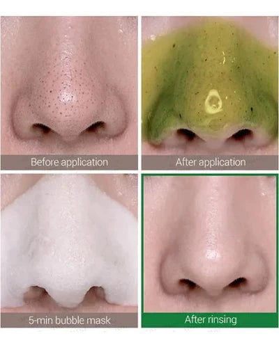 SOME BY MI SOME BY MI Miracle Bye Bye 30 Days Blackhead Miracle Green Tea Tox Bubble Cleanser 120g Cleansers