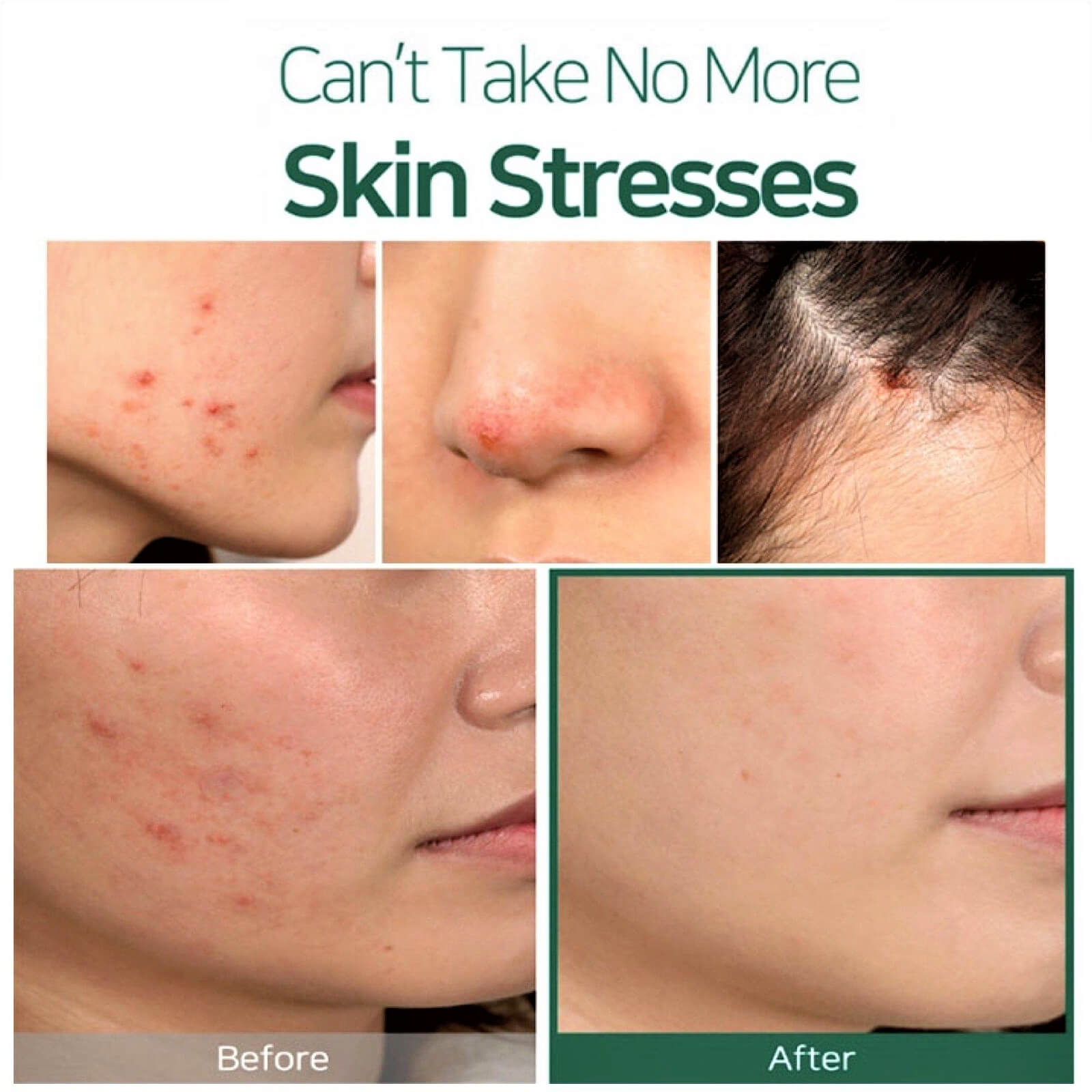 SOME BY MI SOME BY MI 30 Days Miracle Tea Tree Clear Spot Oil 10ml Skin Care