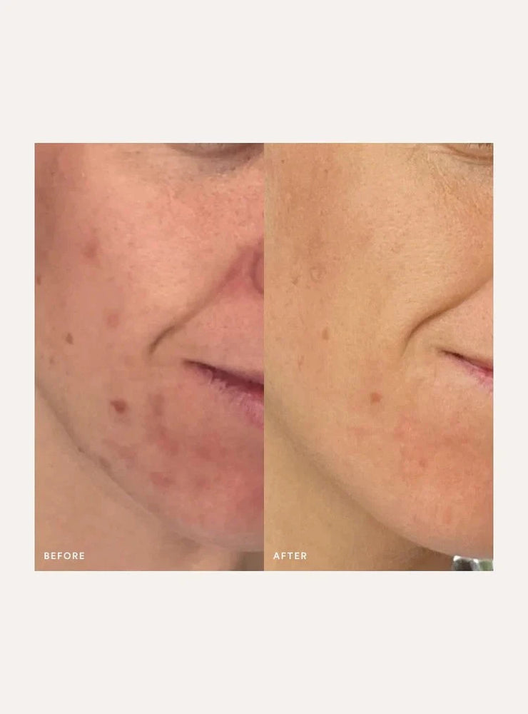 The Beauty Chef The Beauty Chef Inner Beauty Support Clear Skin 150g Wellness