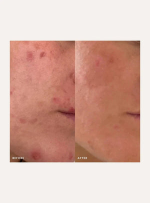 The Beauty Chef The Beauty Chef Inner Beauty Support Clear Skin 150g Wellness
