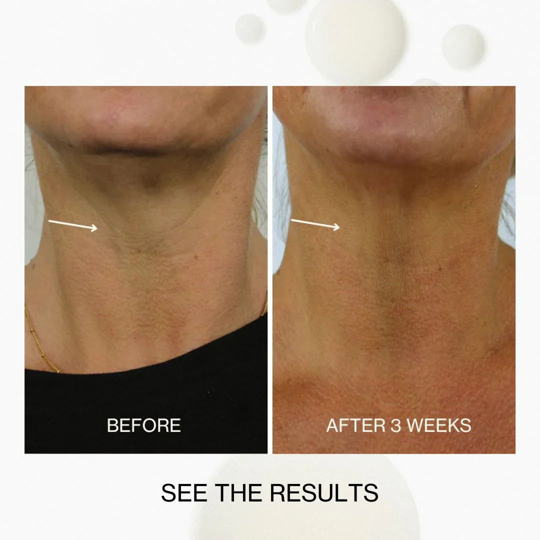 The Jojoba Company The Jojoba Company Neck & Decolletage Lifting Concentrate 50ml Skin Care