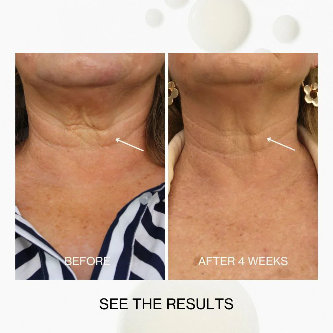 The Jojoba Company The Jojoba Company Neck & Decolletage Lifting Concentrate 50ml Skin Care