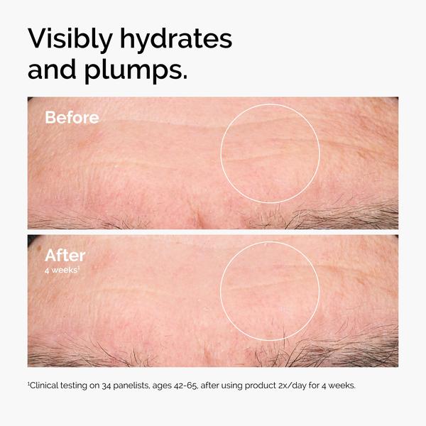 The Ordinary The Ordinary Hyaluronic Acid 2% + B5 60ml Anti-Ageing Serum