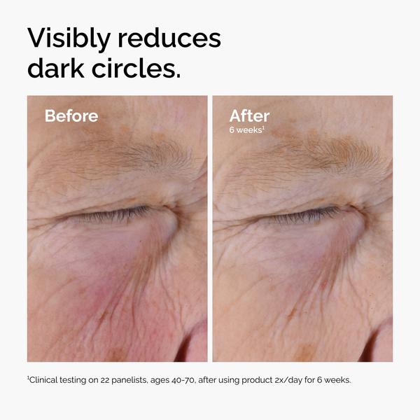 The Ordinary The Ordinary Caffeine Solution 5% + EGCG 30ml Eye Treatments