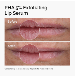The Ordinary The Ordinary PHA 5% Exfoliating Lip Serum 15ml Lip Treatments