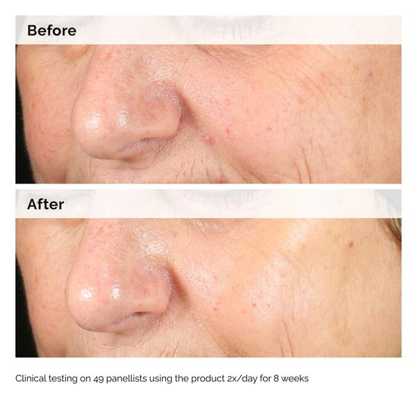 The Ordinary The Ordinary Alpha Arbutin 2% + HA 60ml Serums & Treatments