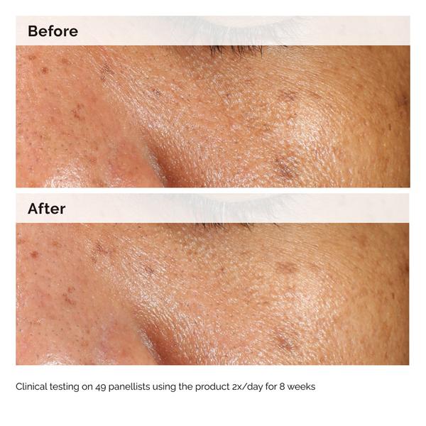 The Ordinary The Ordinary Alpha Arbutin 2% + HA 60ml Serums & Treatments